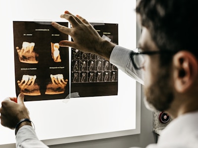 Dental Veneers before and after